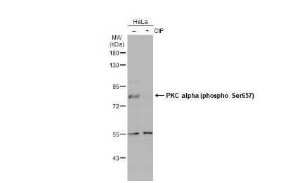 Western Blot: PKC alpha [p Ser657] Antibody [NBP3-13311]